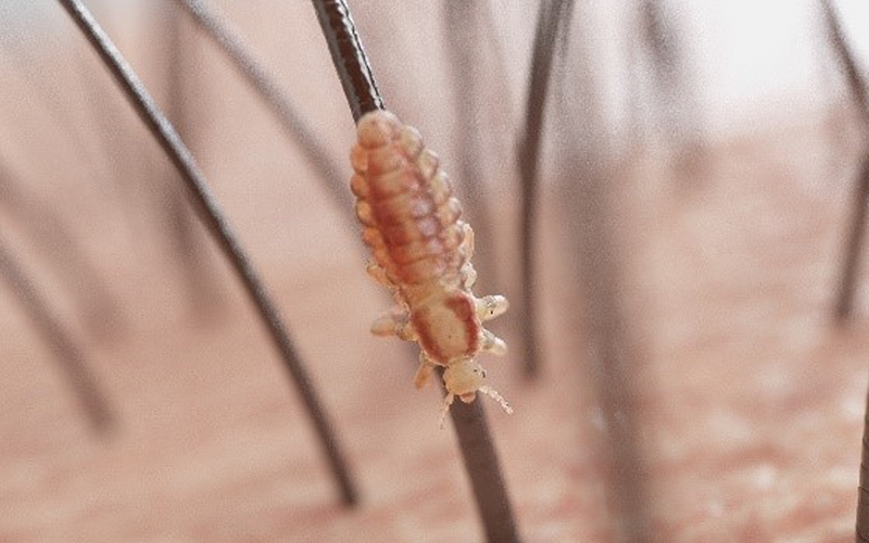Die Kopflaus ist ein harmloser Ektoparasit, der ausschließlich den Menschen befällt. Bildnachweis: AdobeStock_244914046_SciePro